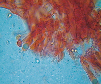 Tricholoma equestre vs. Tricholoma chrysophyllum